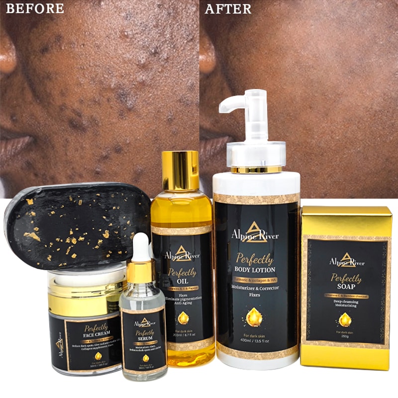 Turmeric Skincare Set, image 1 of 6